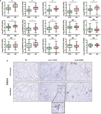 Corrigendum: Non-Invasive Diagnosis for Acute Rejection Using Urinary mRNA Signature Reflecting Allograft Status in Kidney Transplantation